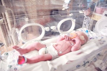 Wcześniak urodzony w 34 tygodniu ciąży