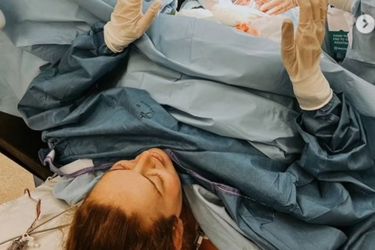 poród, cesarka, cesarskie cięcie, cesarka z asystą rodzącej, asysta rodzącej, planowe cesarskie cięcie