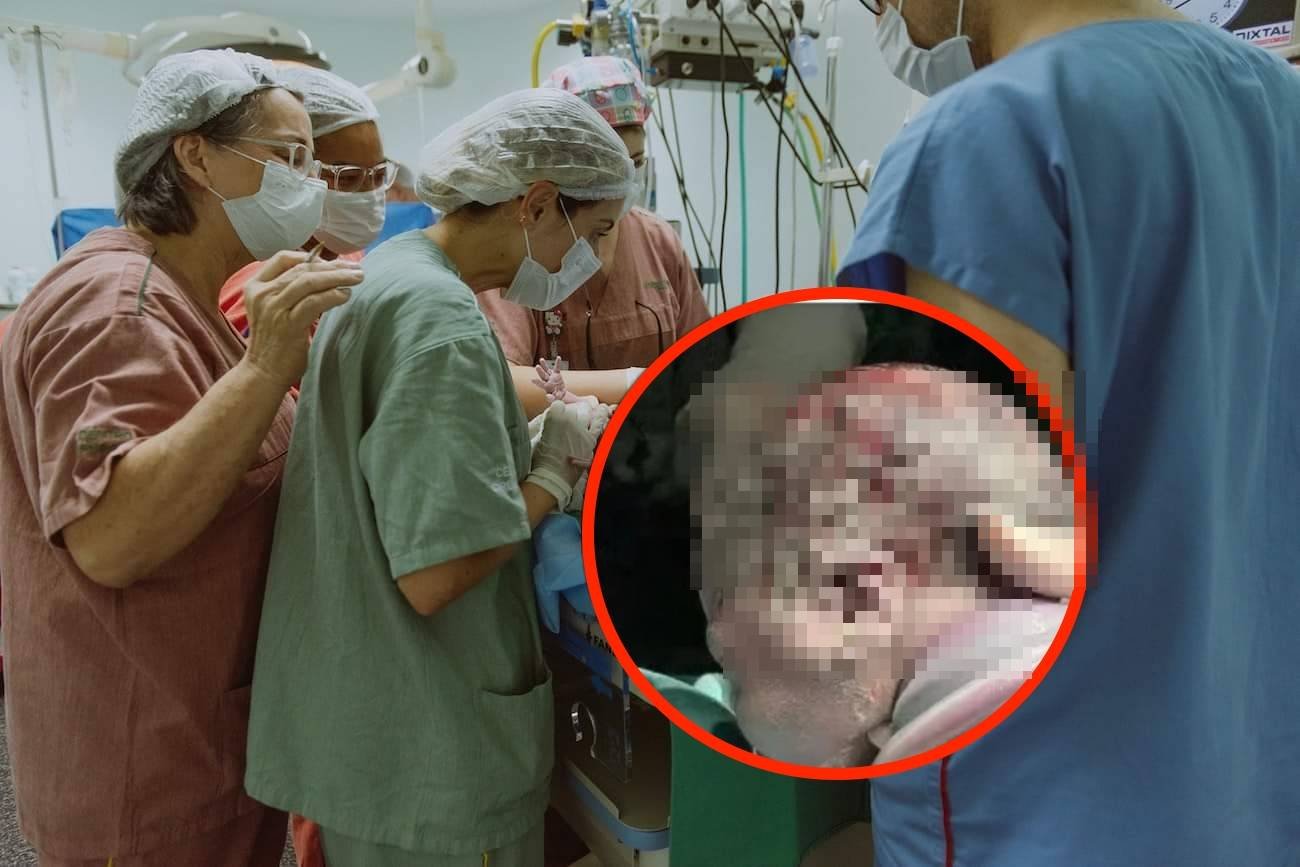 Poród: kolizja pępowinowa