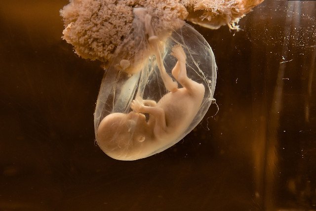 Płód w brzuchu matki w 3 miesiącu ciąży.