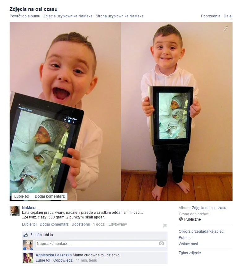 Dzisiaj na naszej tablicy znaleźliśmy takie piękne zdjęcie z tym budującym podpisem: Lata ciężkiej pracy, wiary, nadziei i przede wszystkim oddania i miłości...
..24 tydz. ciąży, 500 gram, 2 punkty w skali apgar.