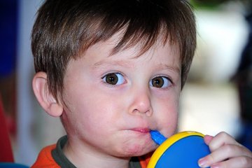 wada wrodzona, wada genetyczna, delecja chromosomu 6, dziecko ze stali, bioniczna dziewczynka