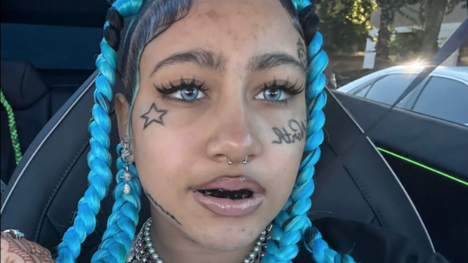 Groźny trend wśród nastolatków. "To szkody, które zostaną z nimi na całe życie" – alarmuje dentysta