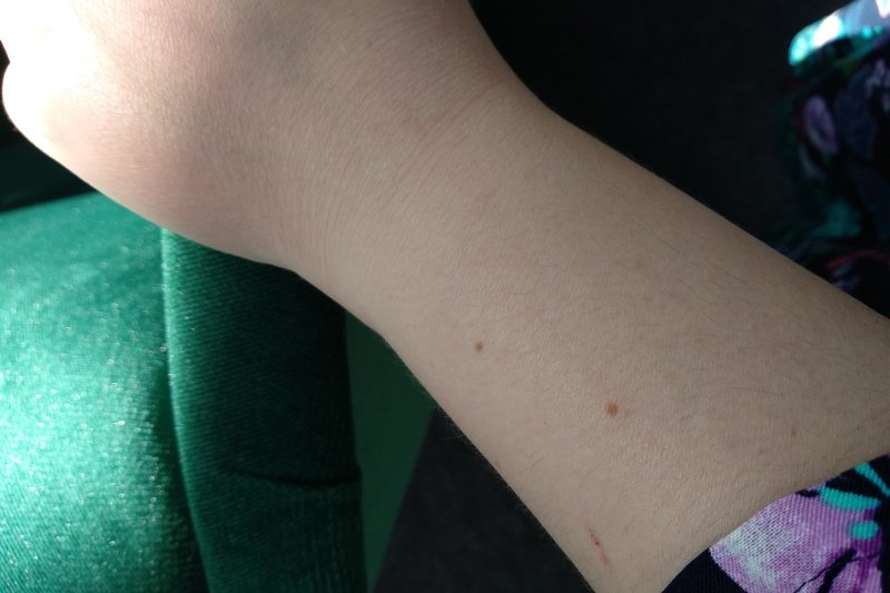 Sprawdźcie, czy też macie pieprzyk na nadgarstku