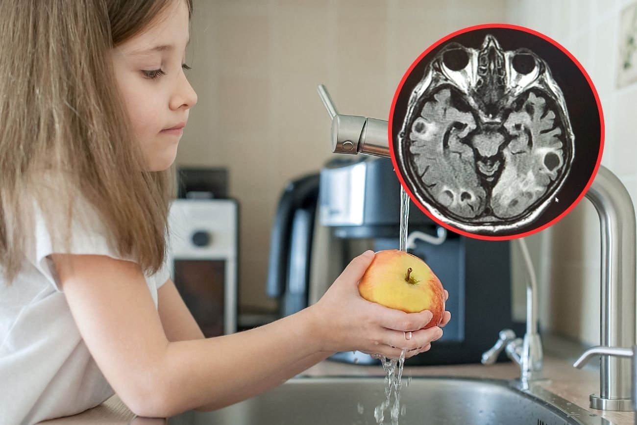 Zdjęcie pasożytów w mózgu obiegło sieć. Teraz każdy dezynfekuje owoce – czy warto?