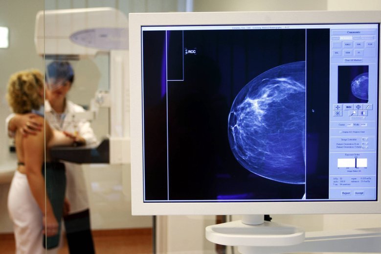 Mammografię i cytologię powinniśmy wykonywać regularnie