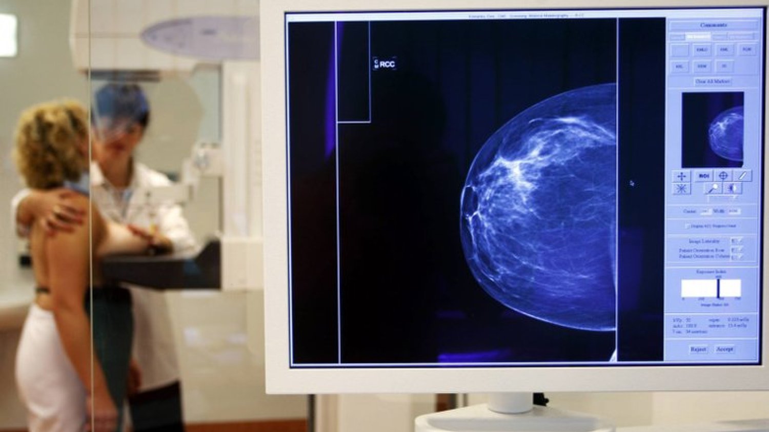 Mammografię i cytologię powinniśmy wykonywać regularnie