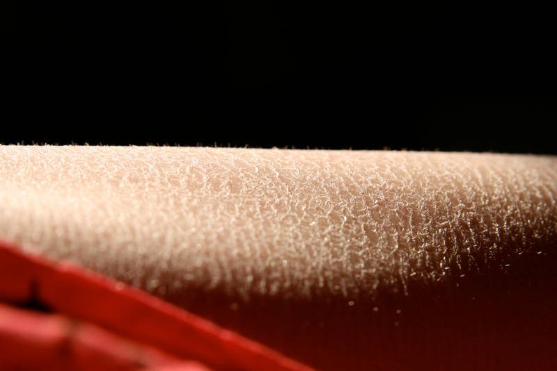 Sucha skóra, na której widać białe płatki to znak, że zbyt rzadko stosujesz pilingi i balsamy do ciała