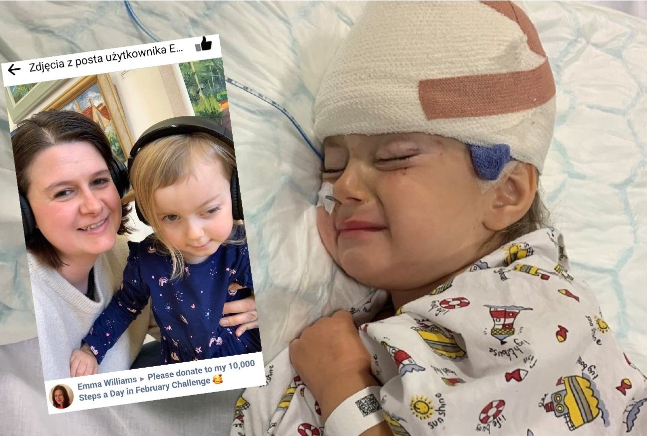 oponiak, lekarze myśleli, że to "leniwe oko"