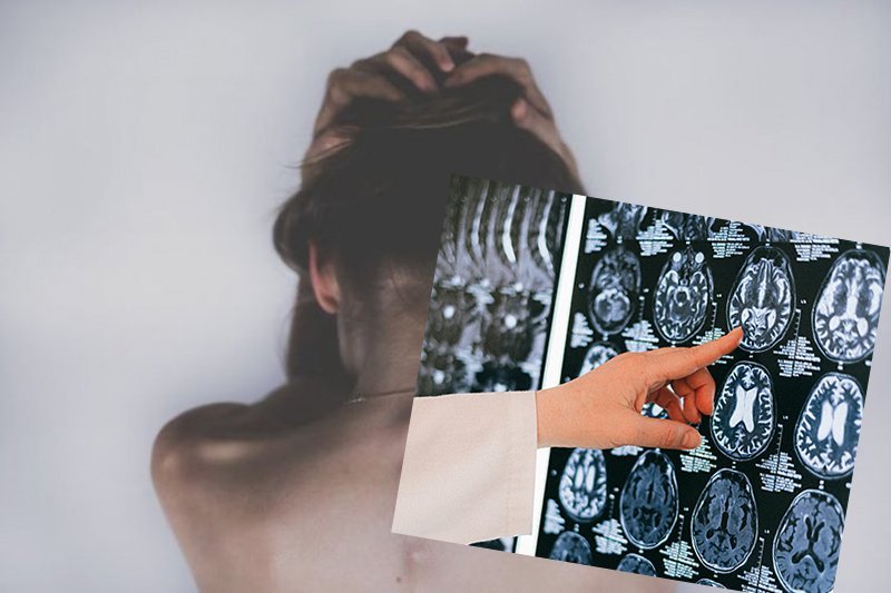 Lekarze badają tajemniczą chorobę mózgu