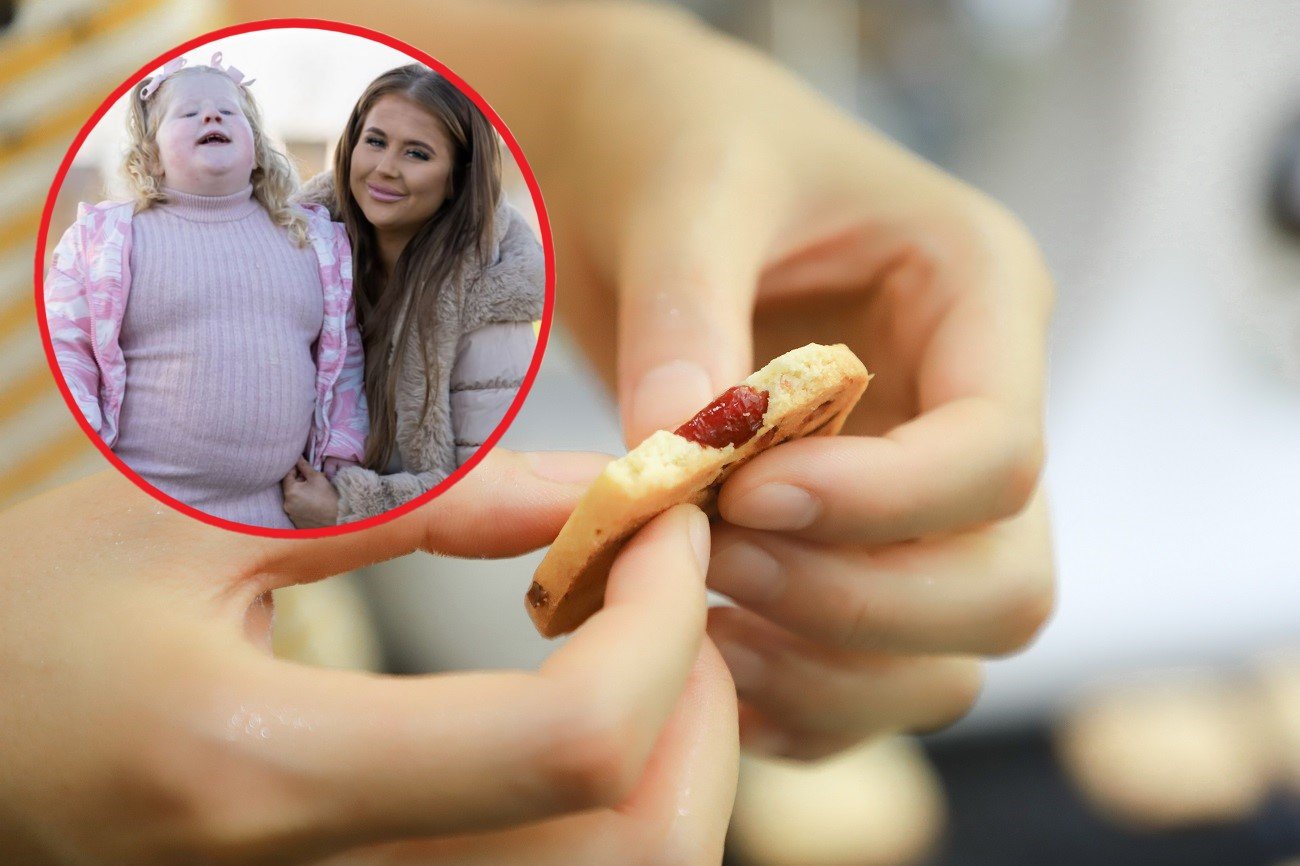 syndrom Pradera-Williego