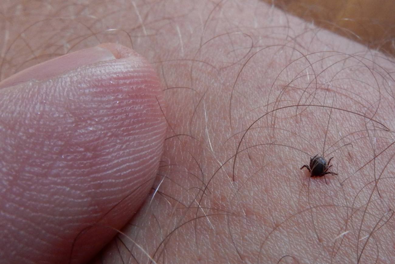 Ślad po kleszczu, ślad po ugryzieniu kleszcza, jak wygląda ślad po kleszczu, czerwony ślad po kleszczu, ugryzienie kleszcza, rumień po kleszczu, ślad po kleszczu zdjęcia