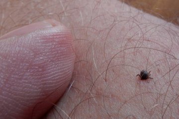 Ślad po kleszczu, ślad po ugryzieniu kleszcza, jak wygląda ślad po kleszczu, czerwony ślad po kleszczu, ugryzienie kleszcza, rumień po kleszczu, ślad po kleszczu zdjęcia