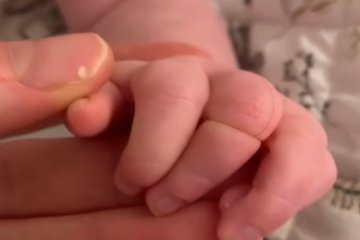 Płacz niemowlaka może wynikać z bólu.