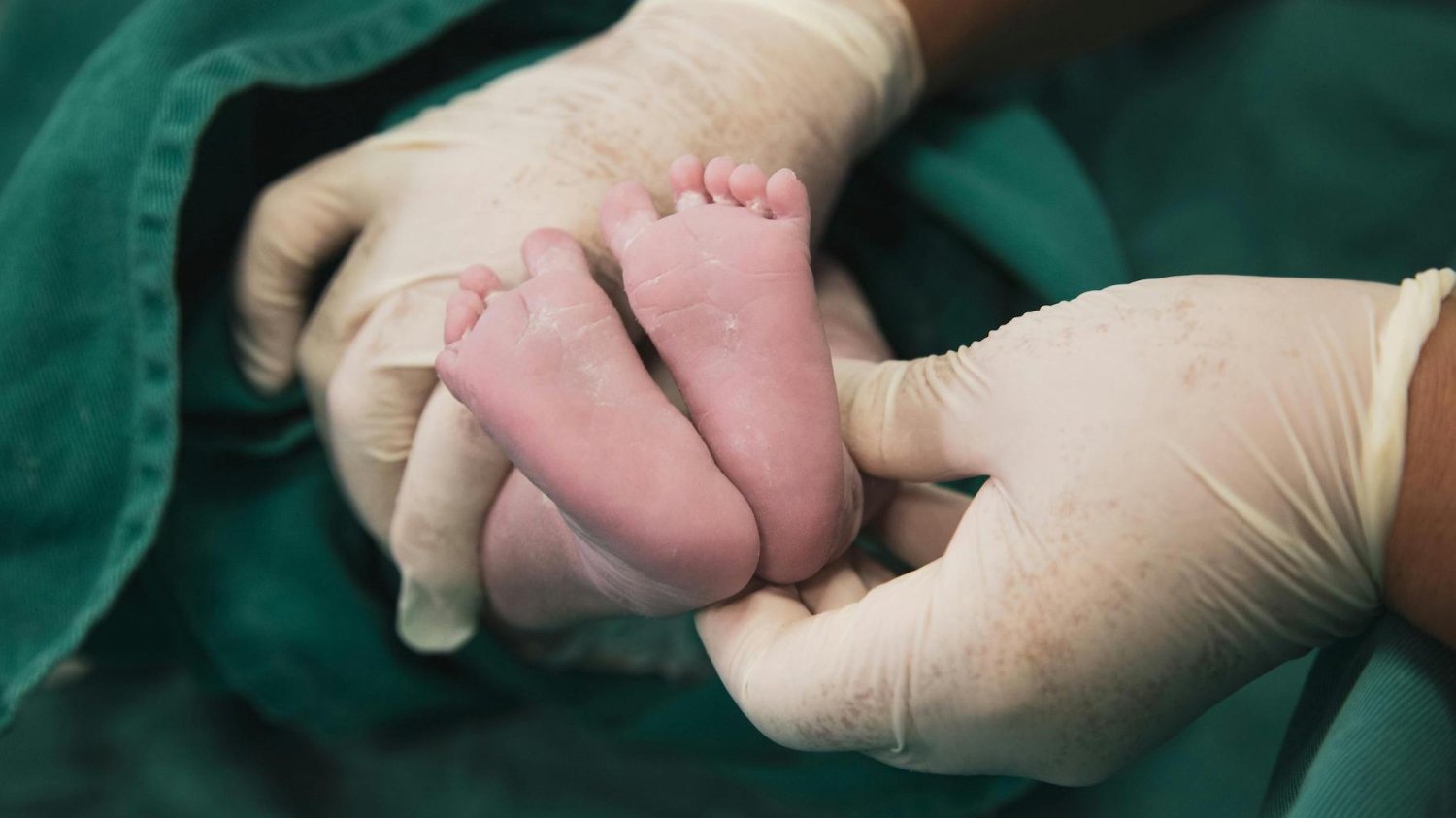Coraz więcej położnych traci pracę. Ministerstwo Zdrowia chce przebranżowienia Na zdjęciu położna przyjmująca poród.