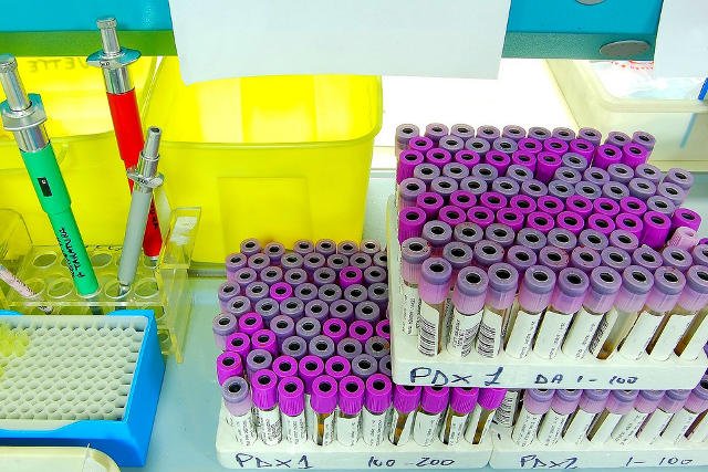 Rewolucyjne odkrycie krakowskich naukowców. Test na paciorkowiec u ciężarnych już niedługo będzie można wykonać w kilka godzin.