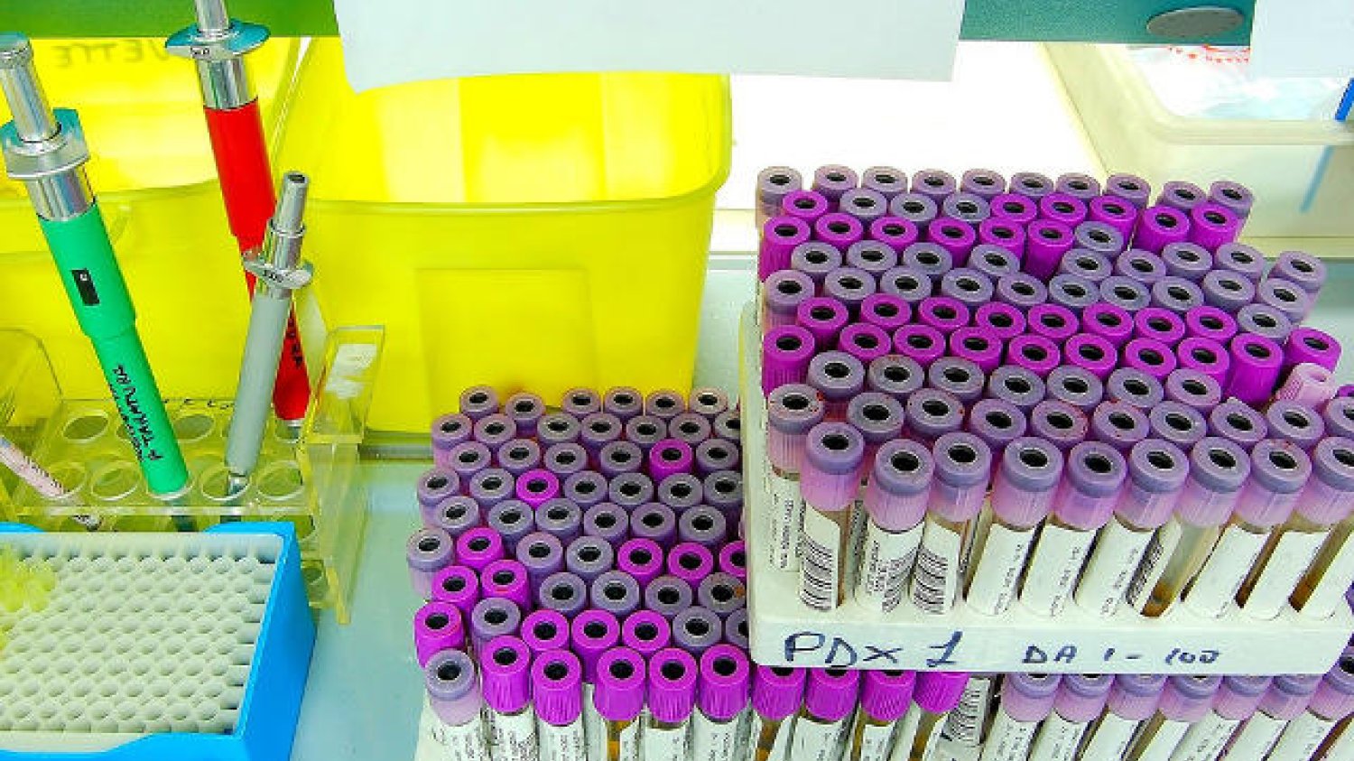 Rewolucyjne odkrycie krakowskich naukowców. Test na paciorkowiec u ciężarnych już niedługo będzie można wykonać w kilka godzin.