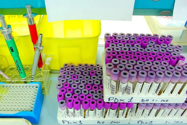 Rewolucyjne odkrycie krakowskich naukowców. Test na paciorkowiec u ciężarnych już niedługo będzie można wykonać w kilka godzin.