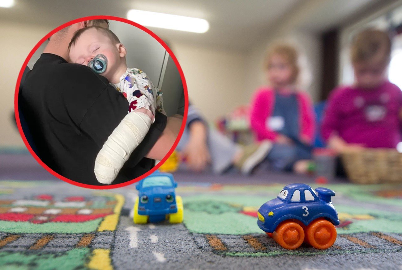 niemowlę doznało poparzenia w żłobku