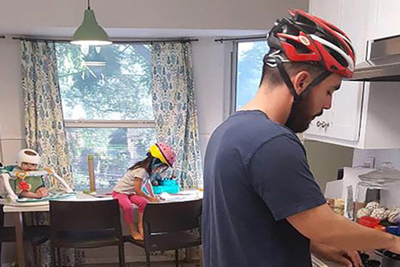 Plagiocefalia to deformacja czaszki niemowlaka, której nie można bagatelizować.