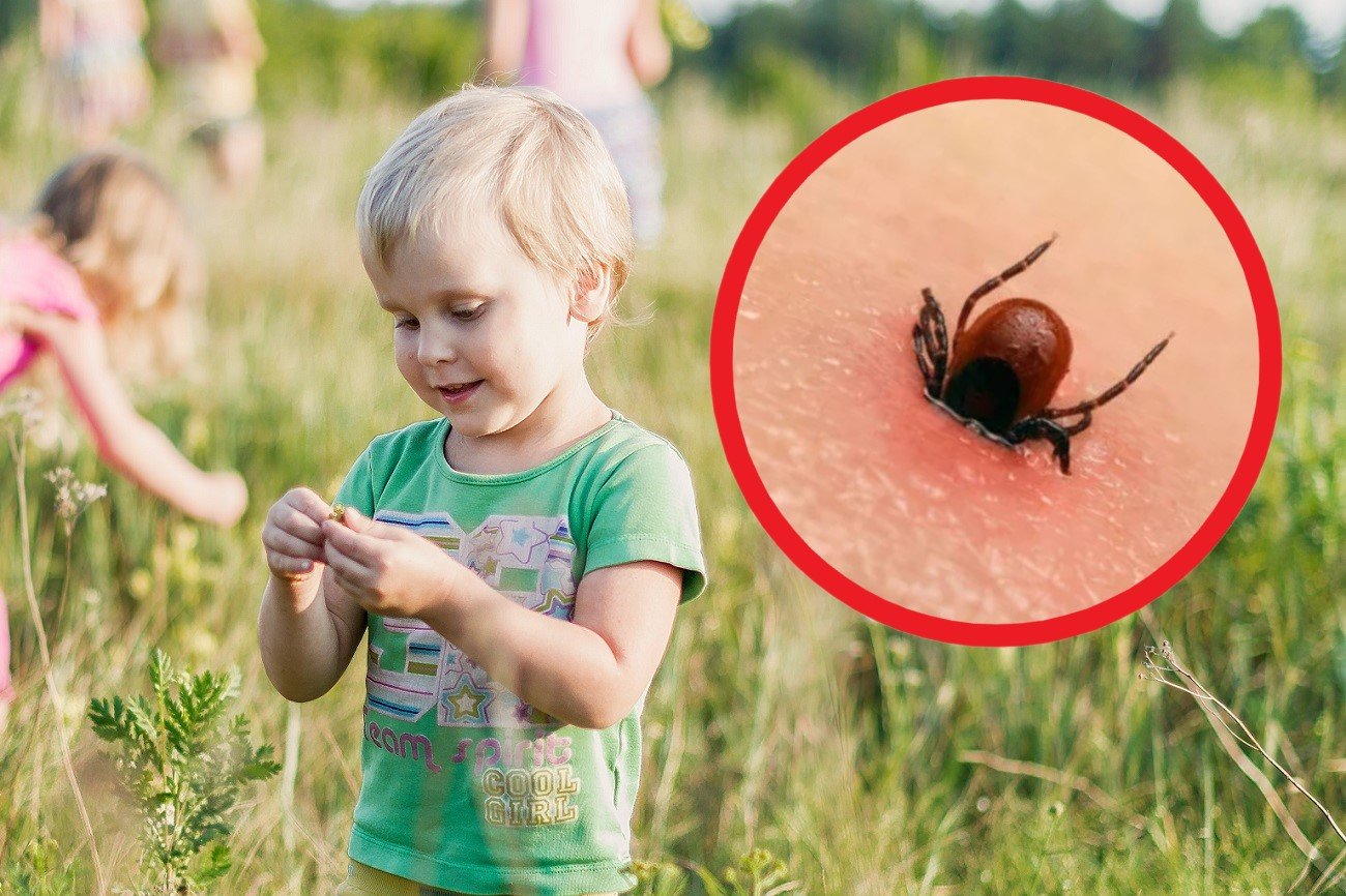 jak usunąć kleszcza?