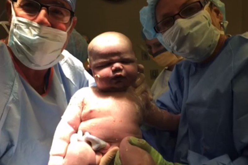 Kobieta urodziła dziecko, które ważyło prawie 7 kg!