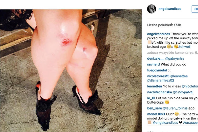 Taki był efekt upadku Candice Swanepoel. Ale mogło skończyć się znacznie poważniejszą raną
