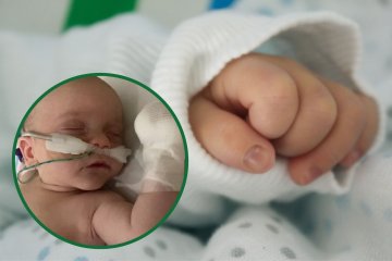 dziecko zakażone wirusem RS