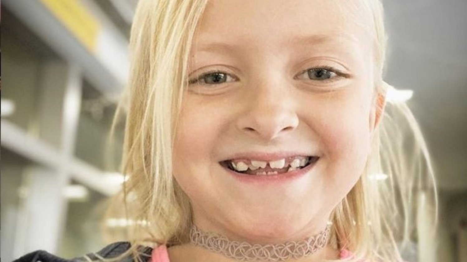 Claire ma 8 lat i pokonała raka. Teraz jej blizny są jej dumą