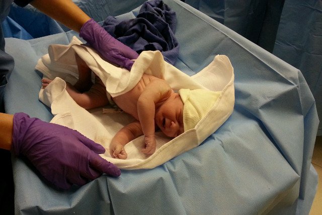 Poród naturalny kontra "cesarka".