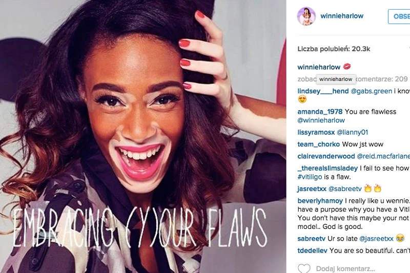 Modelka Winnie Harlow