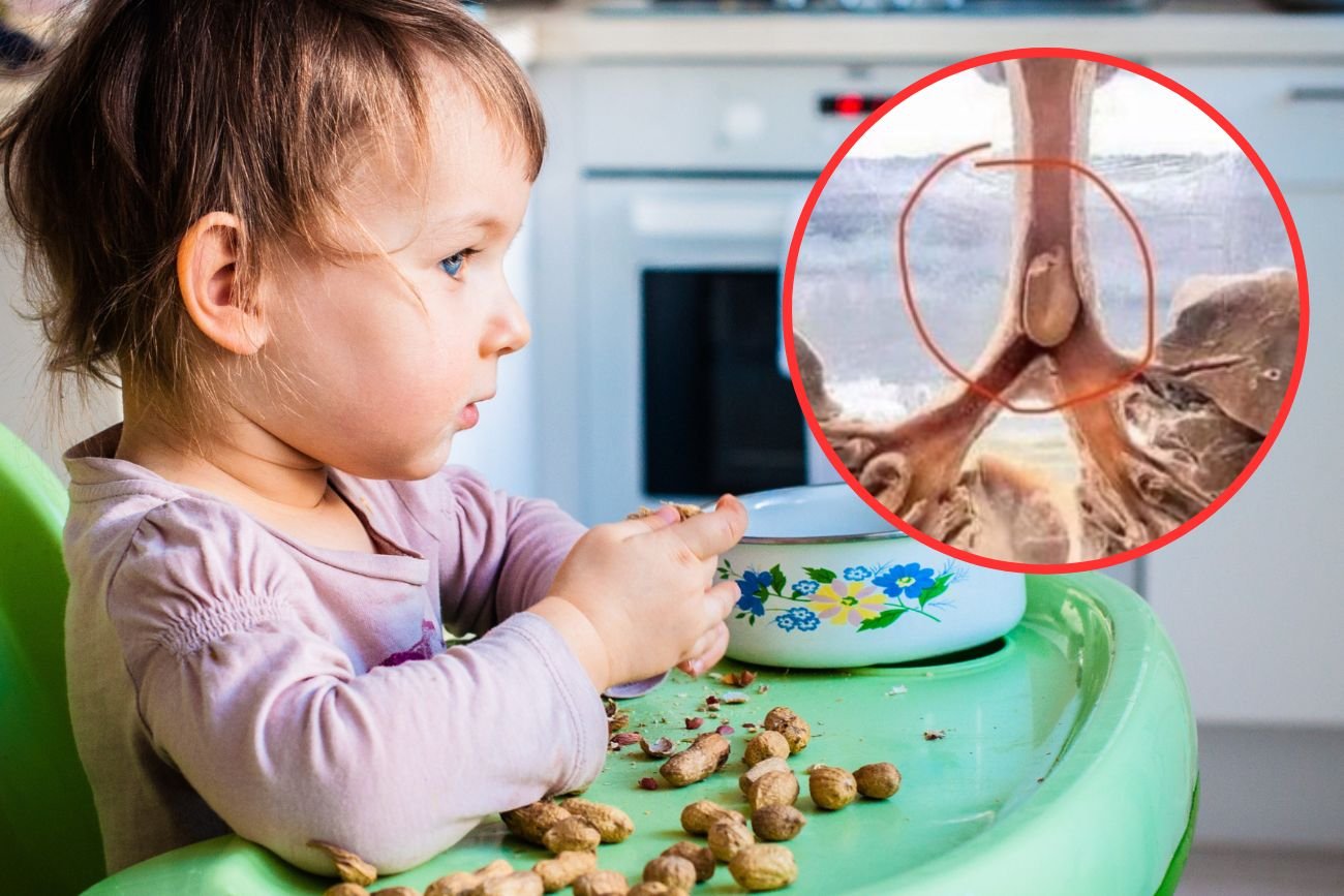 małe dziecko jedzące orzechy może się zadławić