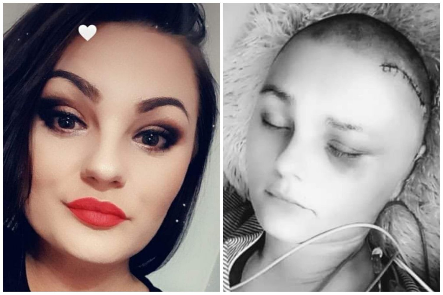 tętniak, mama piątki, kinga osińska, pomagamy, apel