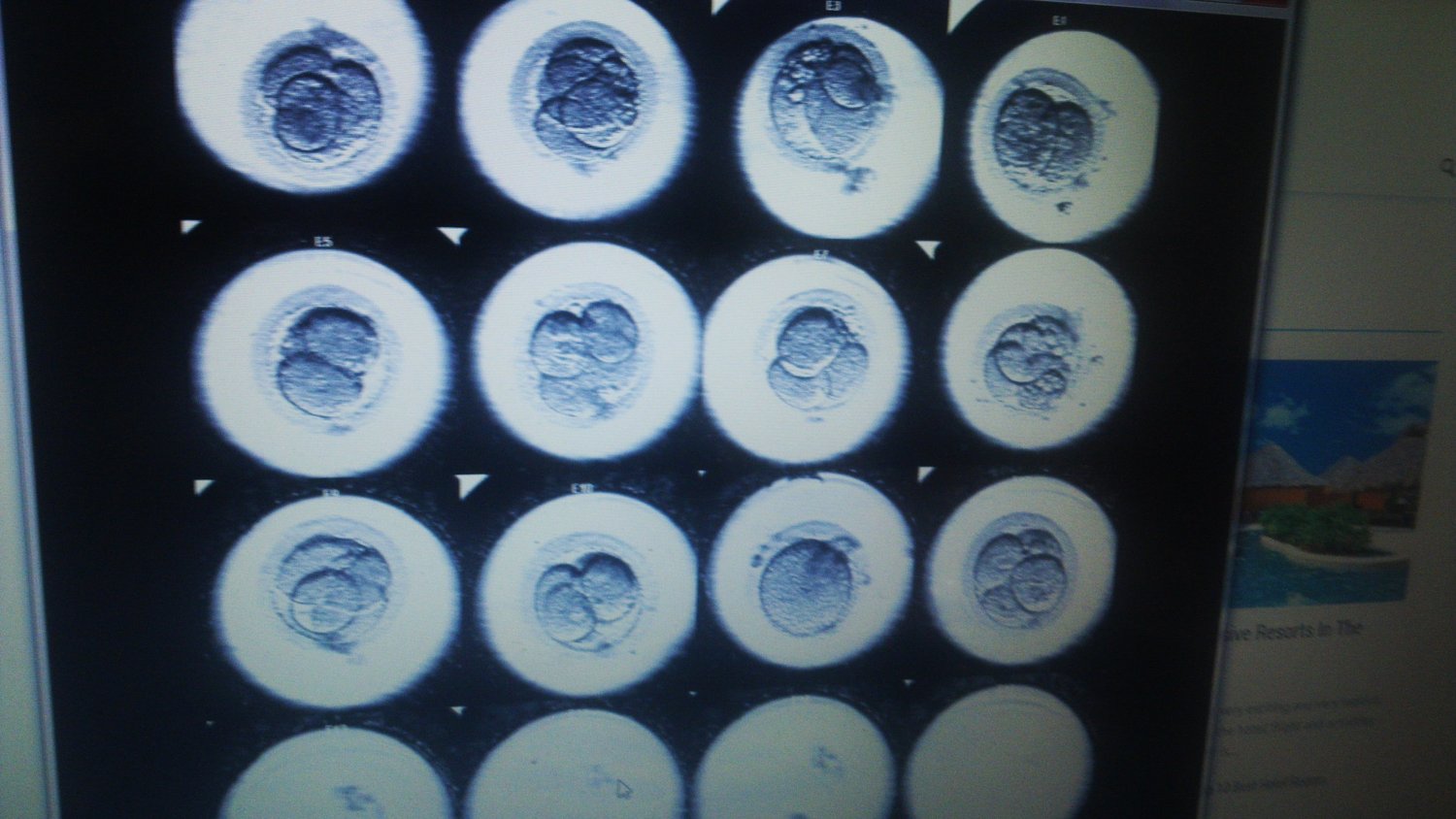 Numer sześć wszczepiono