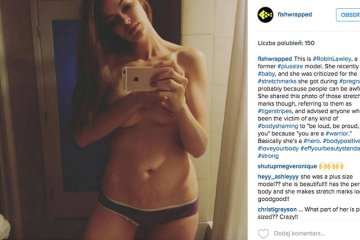 Modelka Robin Lawley nie wstydzi się wyglądu swojej skóry. Wie, że nikt nie jest doskonały i z rozstępami też można być i czuć się piękną kobietą! Szczególnie po urodzeniu dziecka