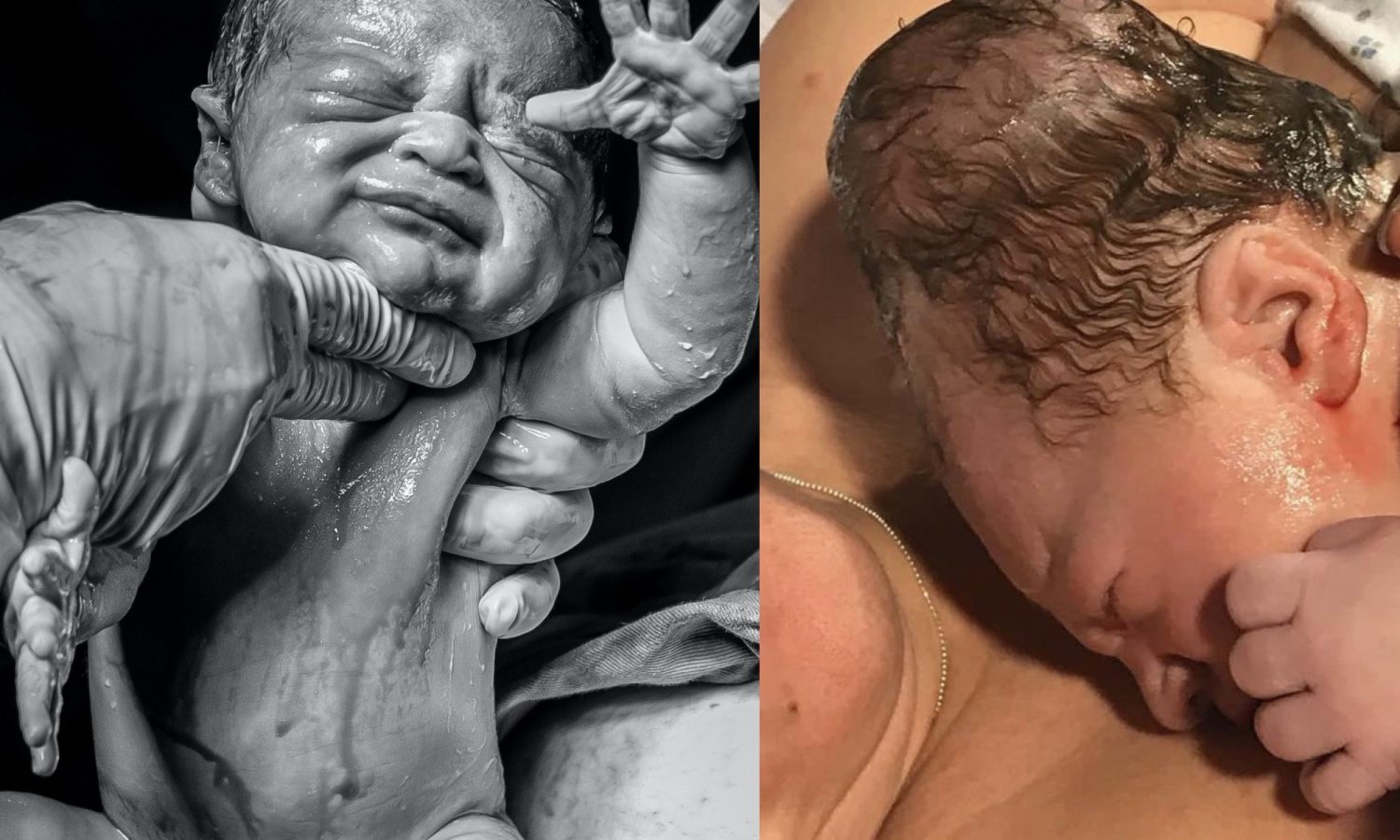 Poród/ Noworodek na piersi matki.