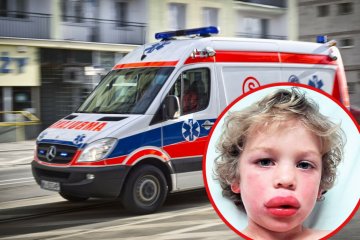 Wstrząs anafilaktyczny: objawy, podanie adrenaliny