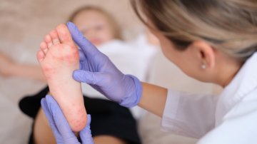 alergia kontaktowa u dziecka