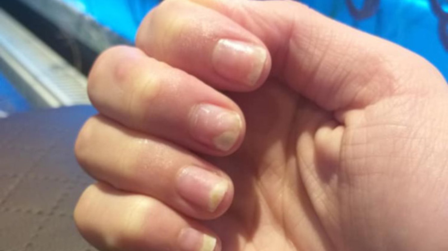 Manicure hybrydowy może wywoływać uczulenia.