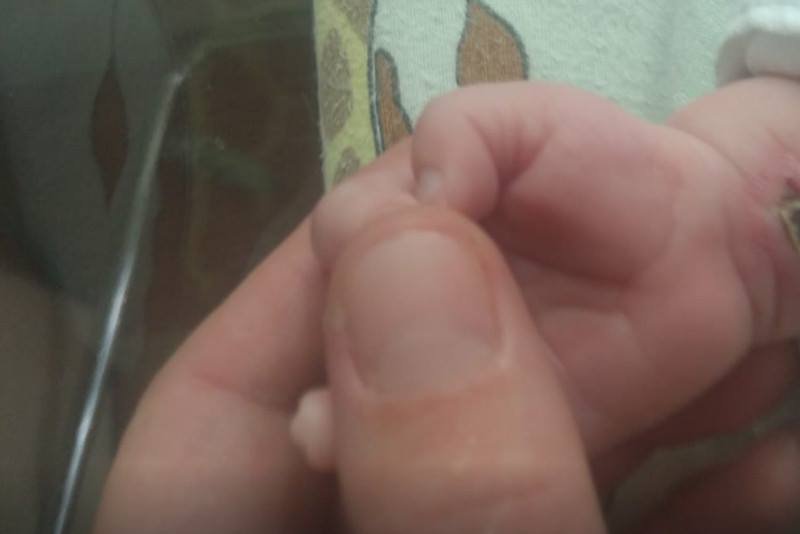 Co stało się w szpitalu w Gorzowie Wlk.?