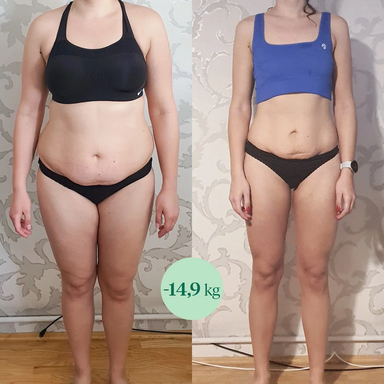 Respo: metamorfoza pacjentki z insulioopornością