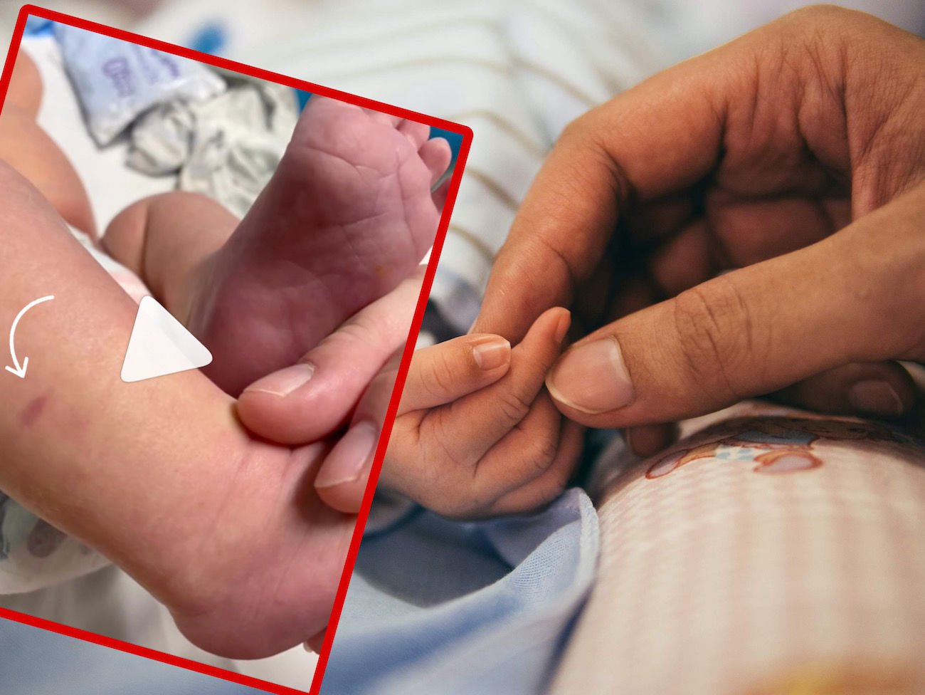 Niepozorna wysypka u dziecka może okazać się śmiertelnym zagrożeniem