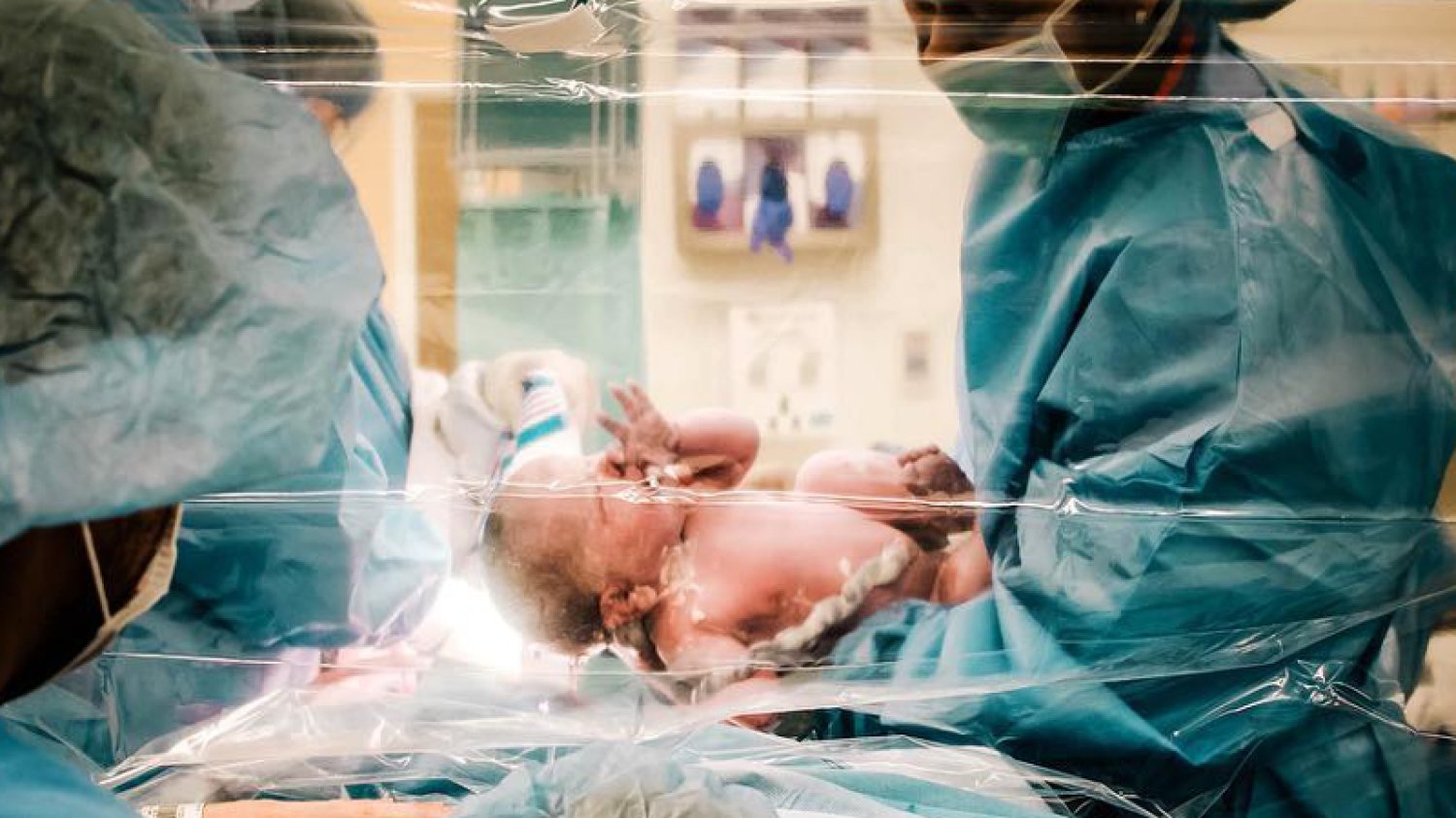 Cesarka za przezroczystą zasłoną alternatywą dla wielu mam?