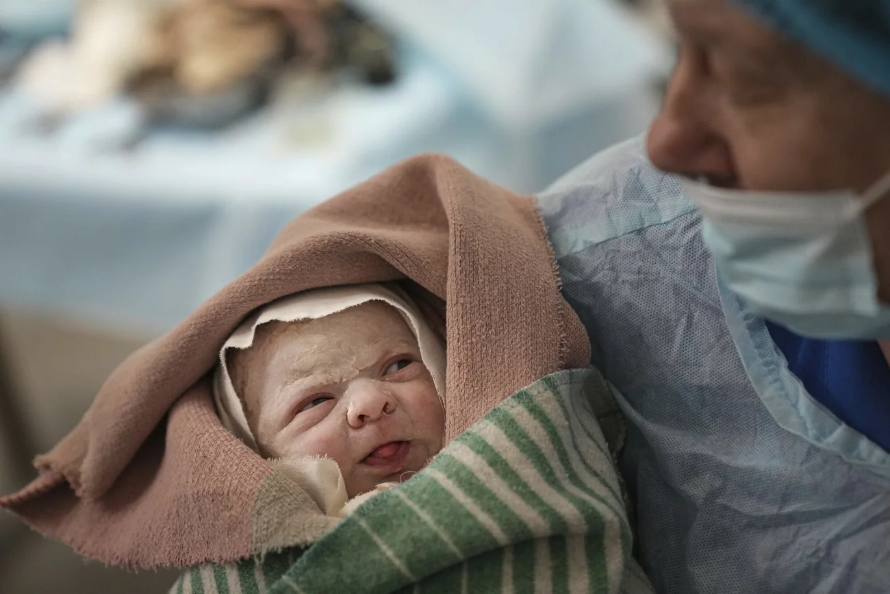 Alana urodziła się przez cesarskie cięcie w szpitalu w Mariupolu w piątek 11 marca 2022 r.