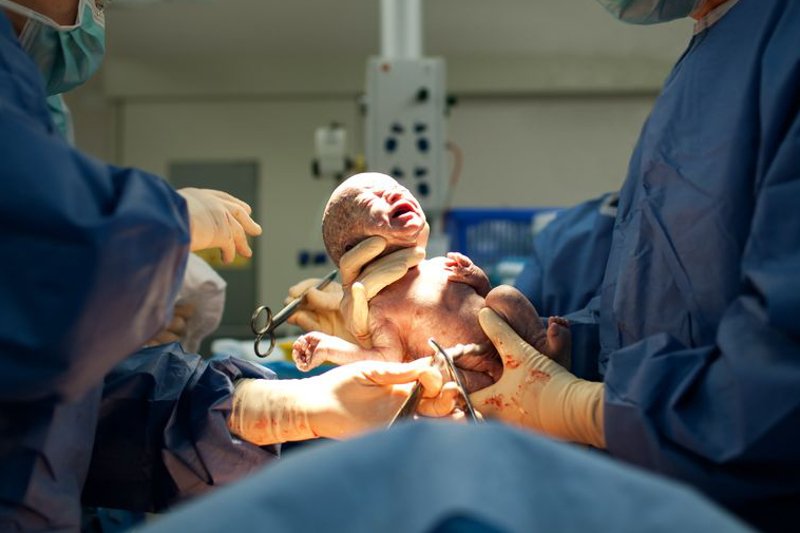 Łożysko przyrośnięte to jedno z najrzadszych powikłań przy porodzie.