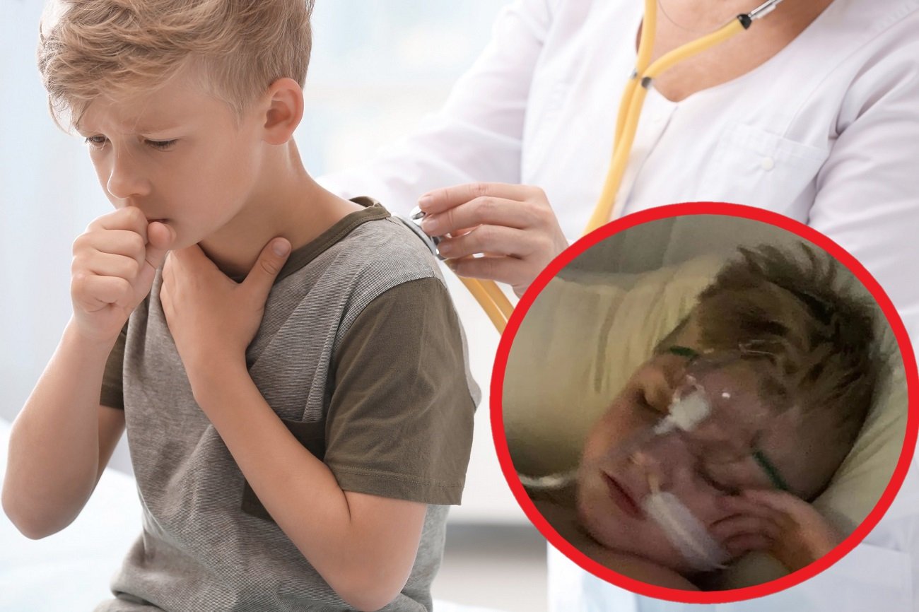 uporczywy kaszel u dziecka