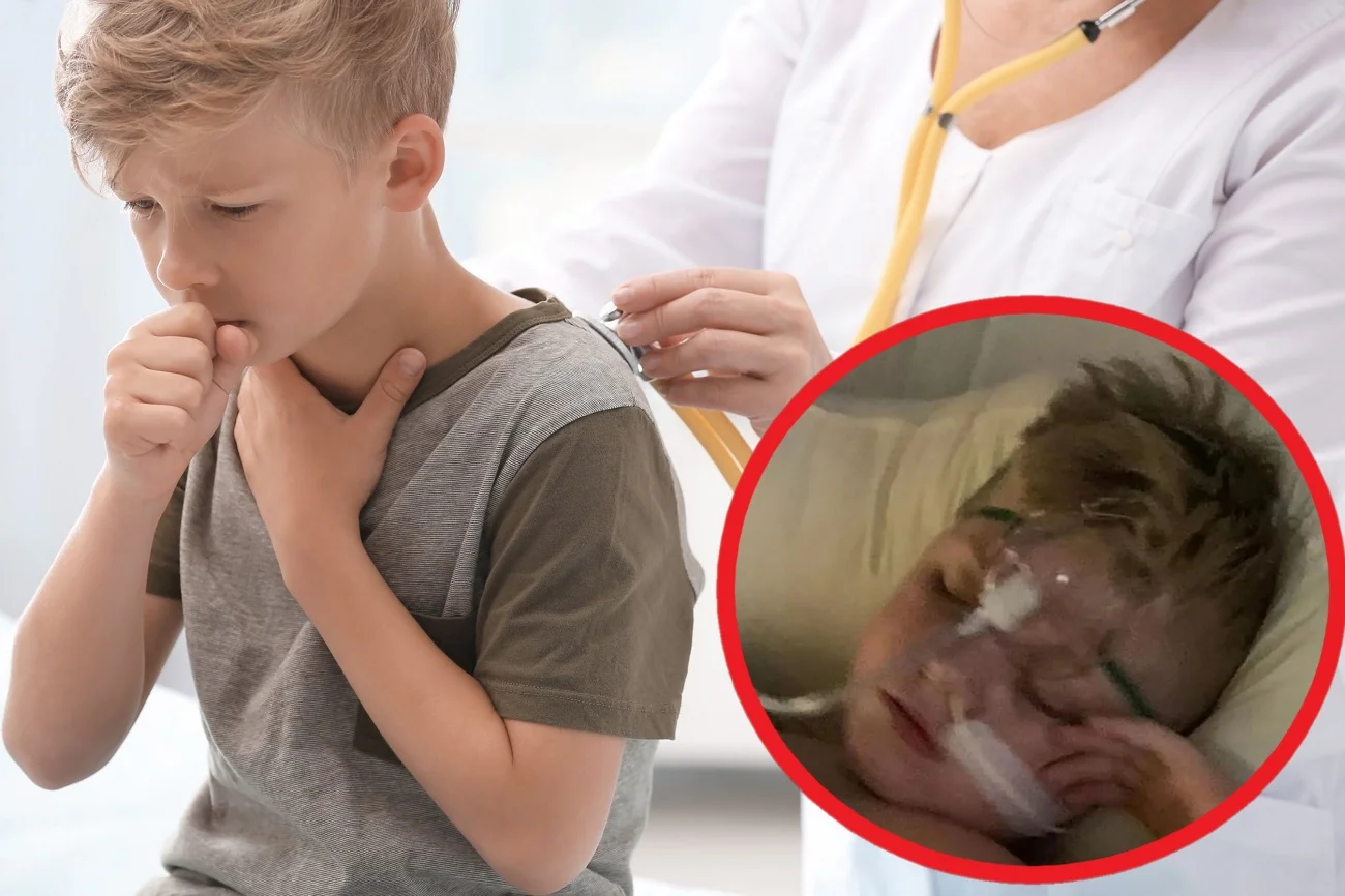 uporczywy kaszel u dziecka