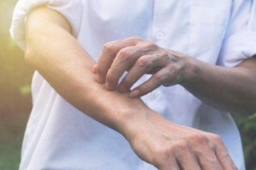 jak pozbyć się meszek z ogrodu