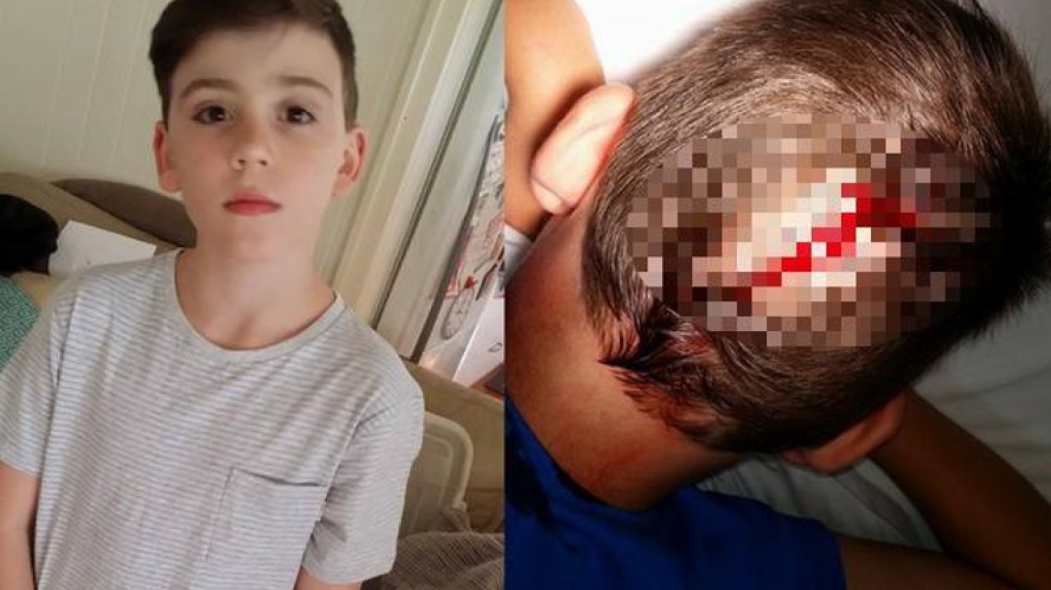 Pass out challenge. Kolejne niebezpieczne wyzwanie w sieci.