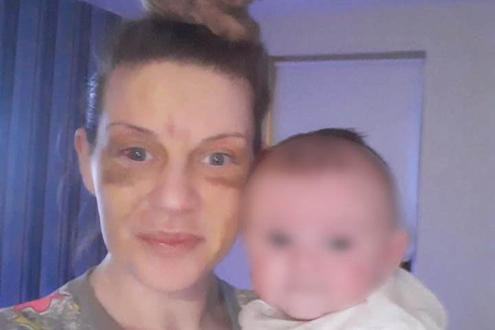 Louise Gilmore z Belfastu - ofiara przemocy wobec kobiet